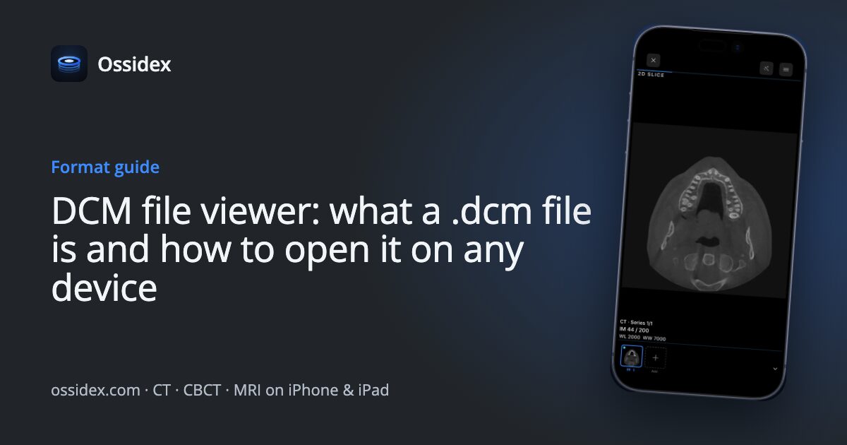 DCM File Viewer: What a .dcm File Is & How to Open It